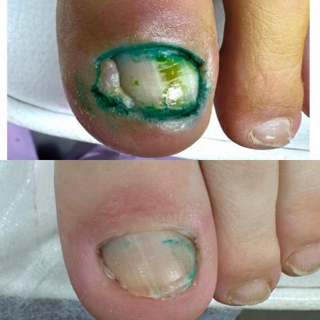 Фотография City nail`s 4