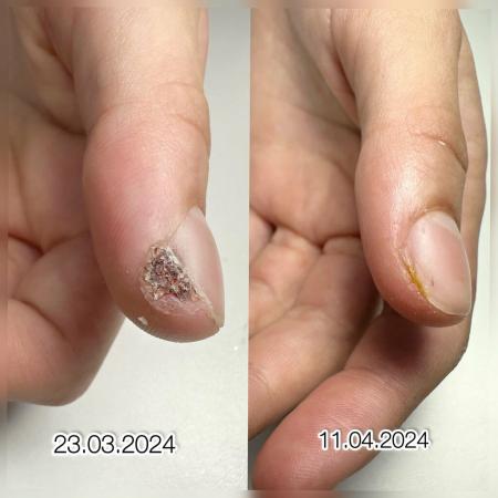 Фотография City nail`s 0
