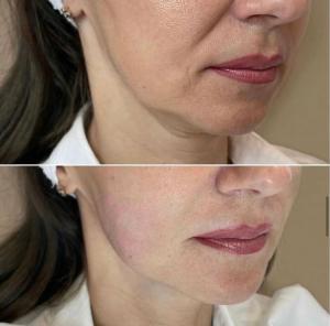 Фотография Студия эстетики тела Алевтины Крымовой 3